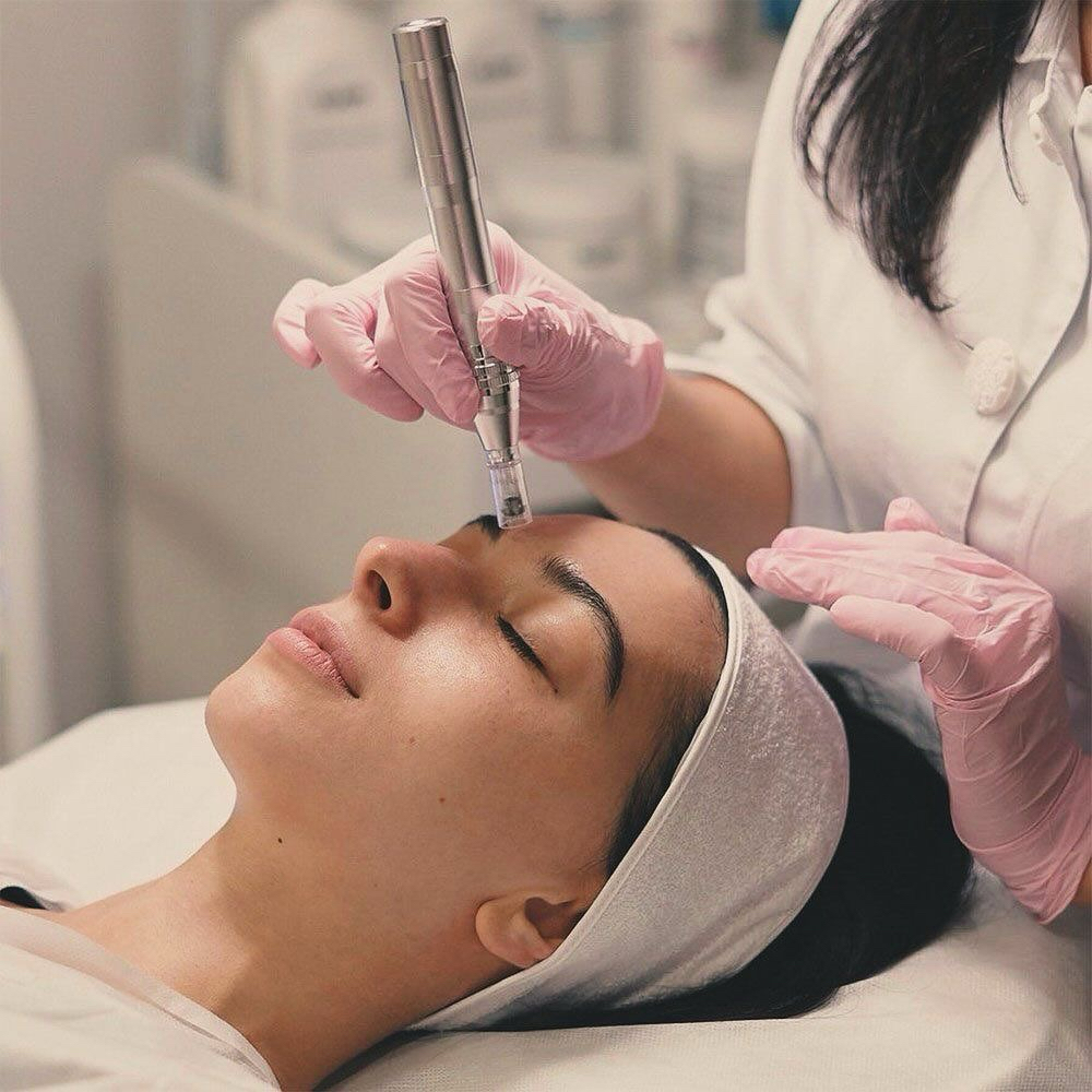 Microneedling at Racha Saab in Dearborn, MI