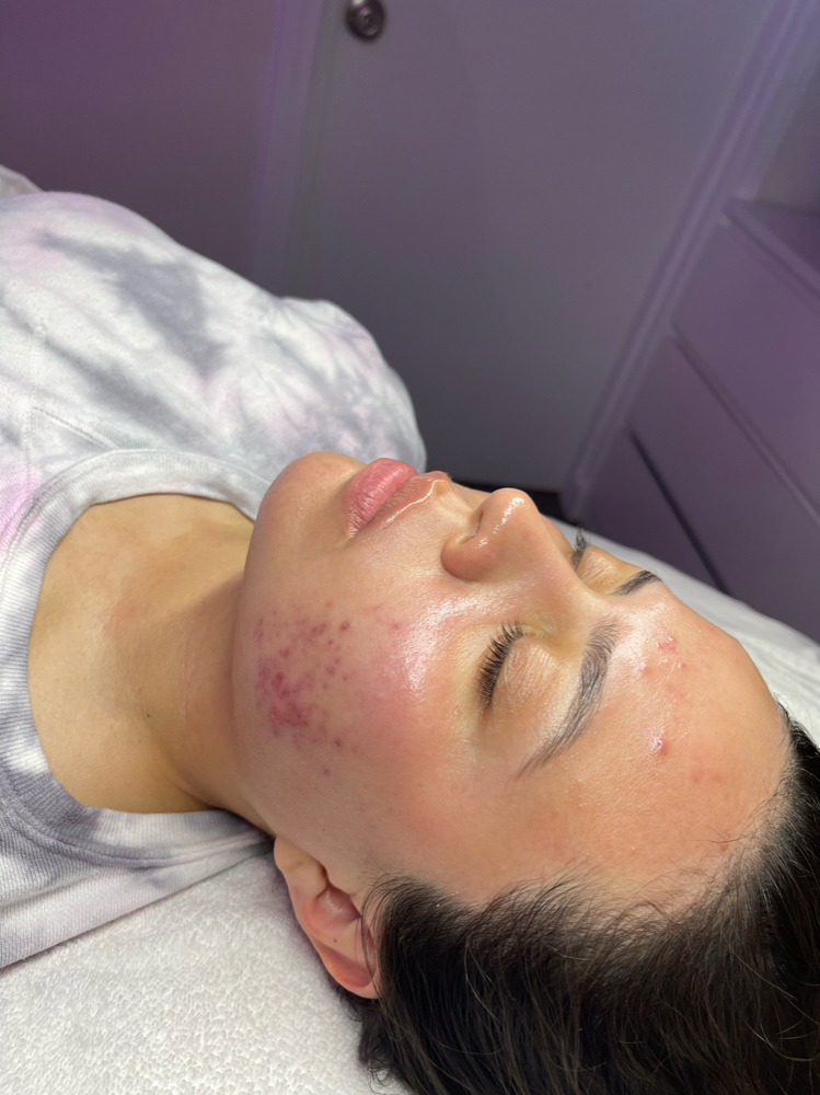 The Purify + Extract Facial