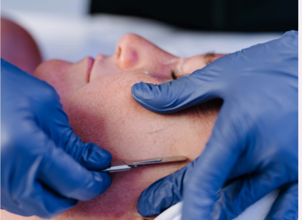 Add On Dermaplane (Must Book Facial