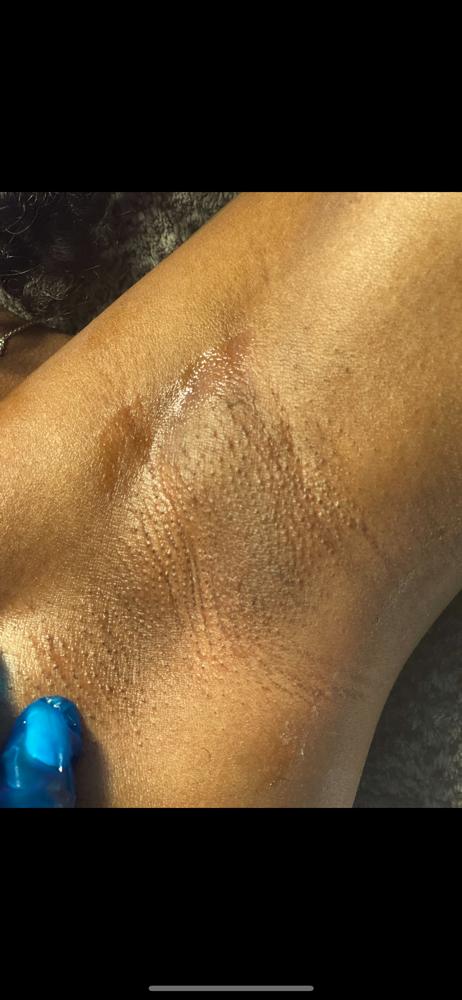 Underarms at The Wax Ladyy in Bedford, OH