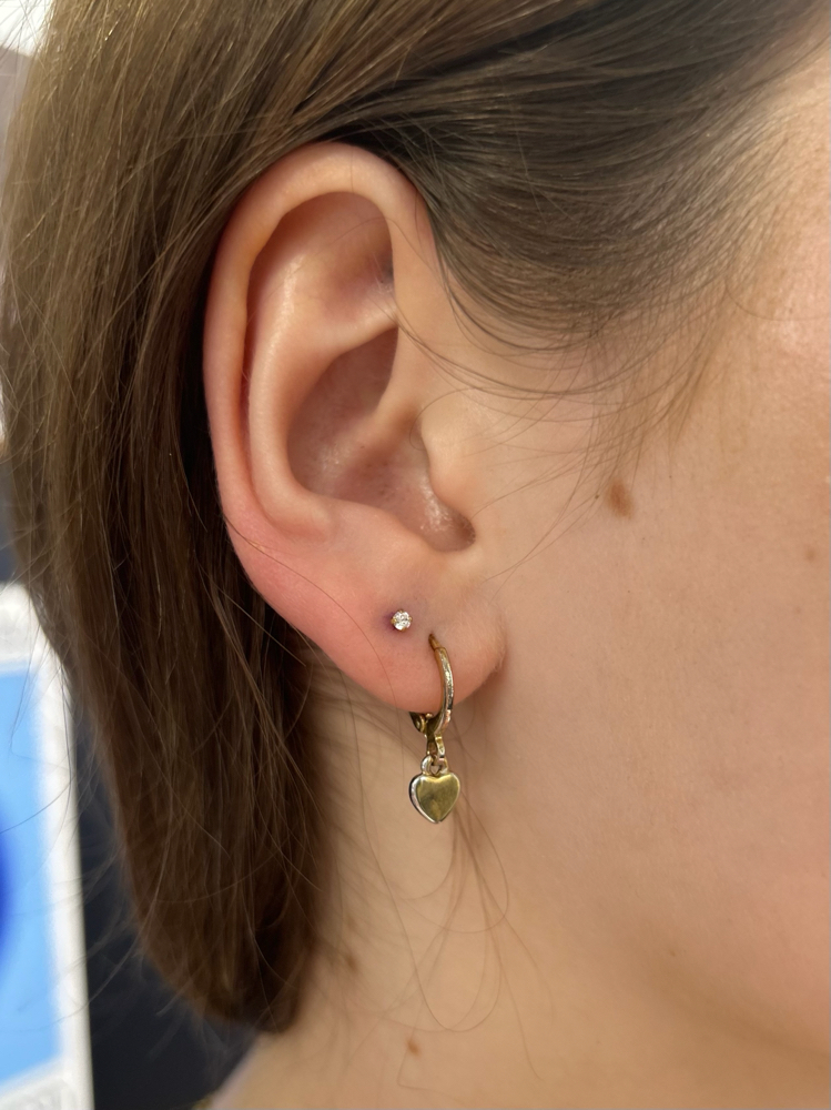 Both Earlobes