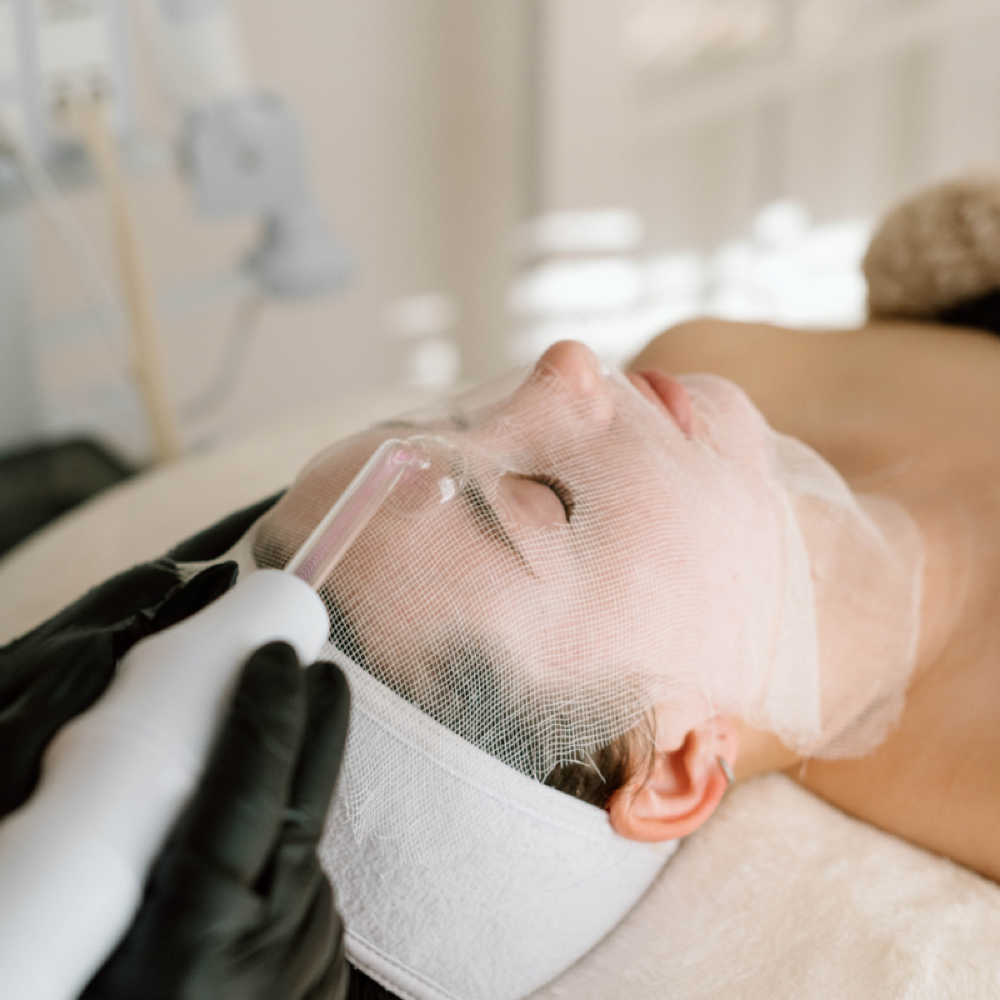 Acne Peel at Kate Anderson Esthetics in Oklahoma City, OK