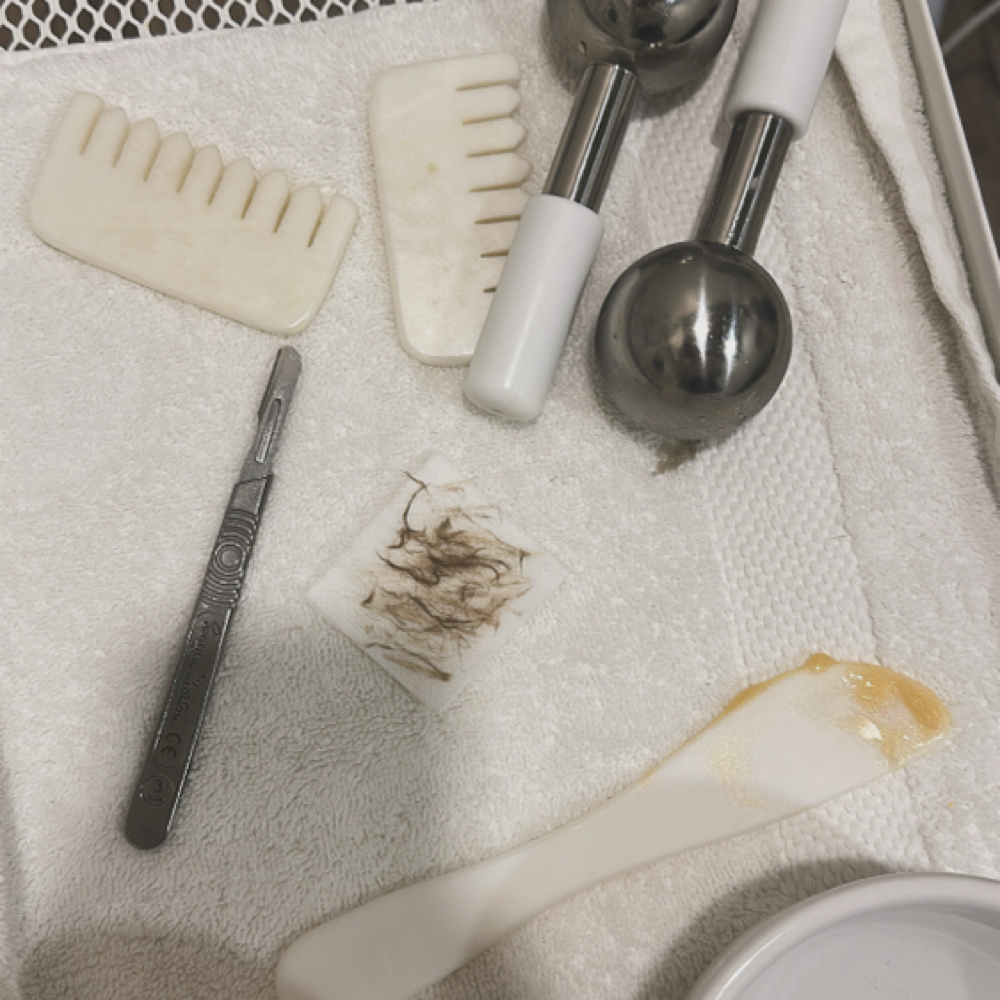 dermaplane facial at Shea Aesthetics in Green Valley, AZ