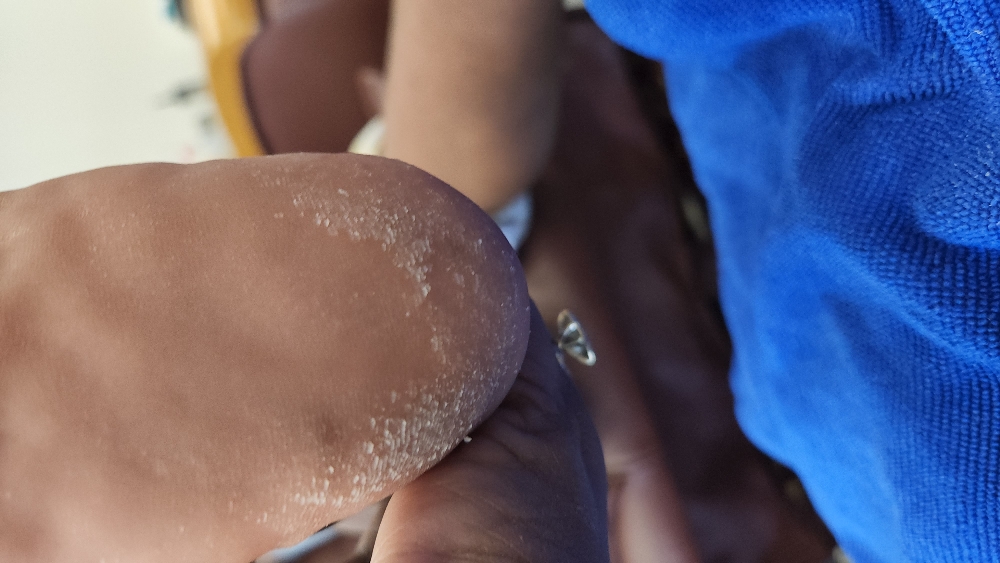 Waterless Pedicure "REC" DIABETES