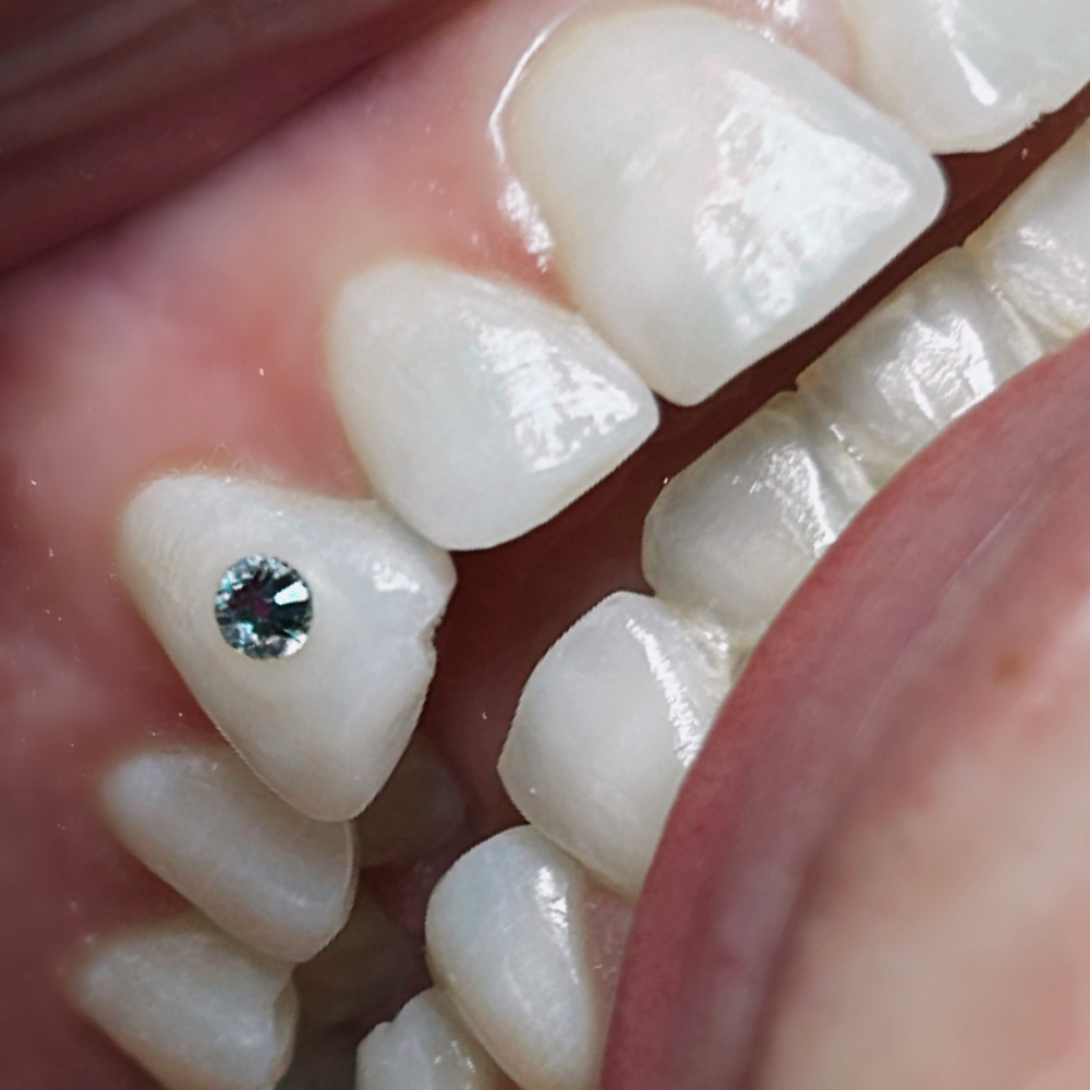 Single Swarovski Tooth Gem