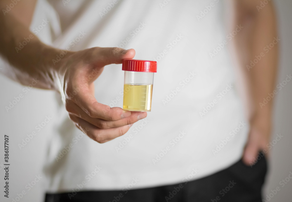12 PANEL DRUG OF ABUSE, URINE