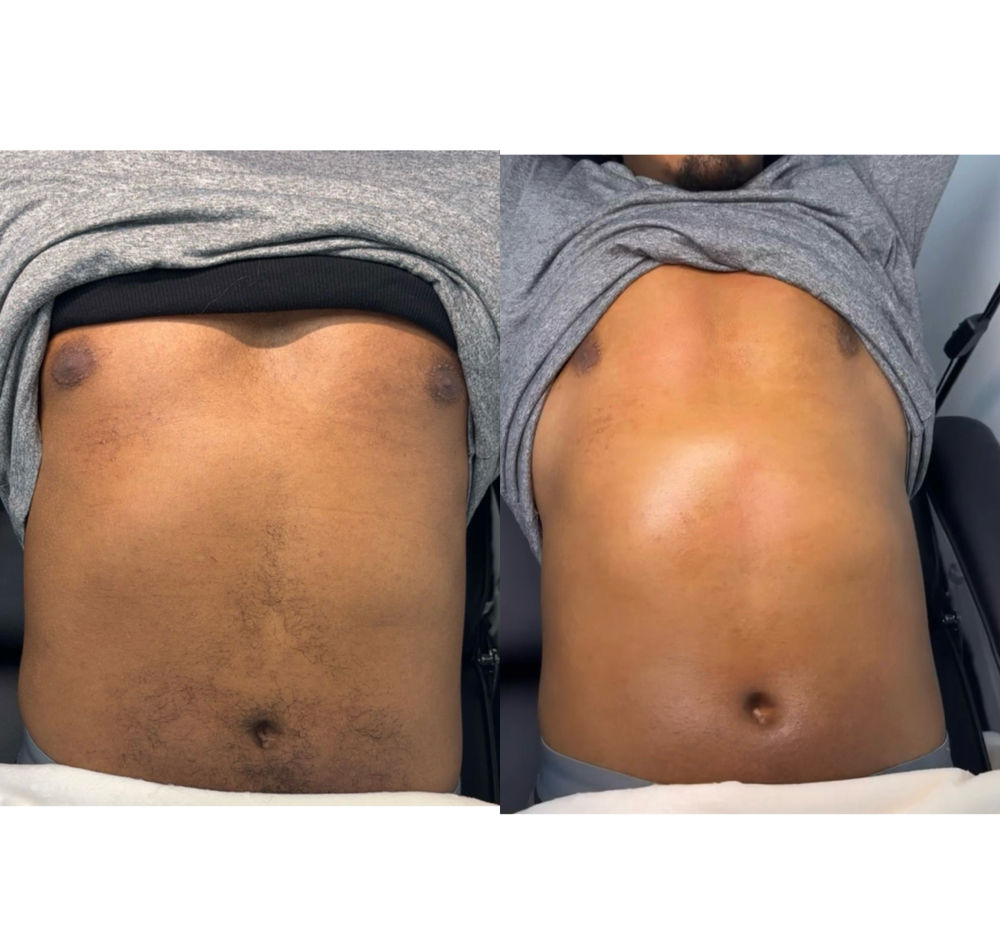 Men Stomach Wax Hair Removal