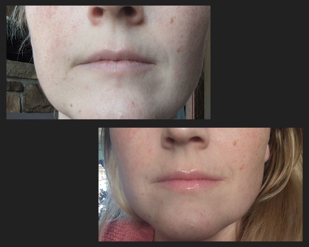 Hydra Gloss Lip Treatment