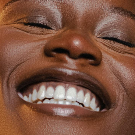 ✨ Gummy Smile at Eden Rose Health and Wellness in Bridgeport, CT