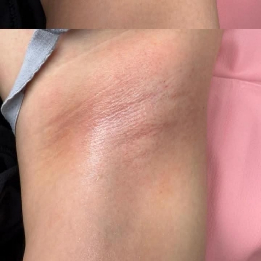 Under Arm Wax at Bidi Bidi Bomb Esthetic’s in Albuquerque, NM