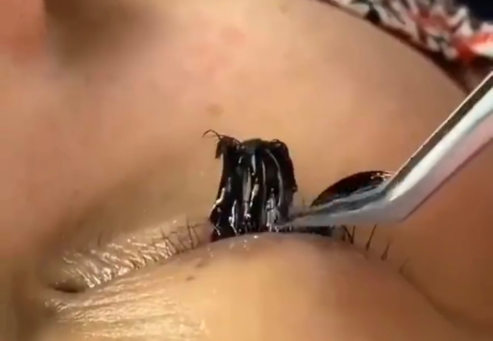 Lash Removal