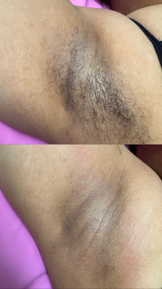 Under Arm Wax