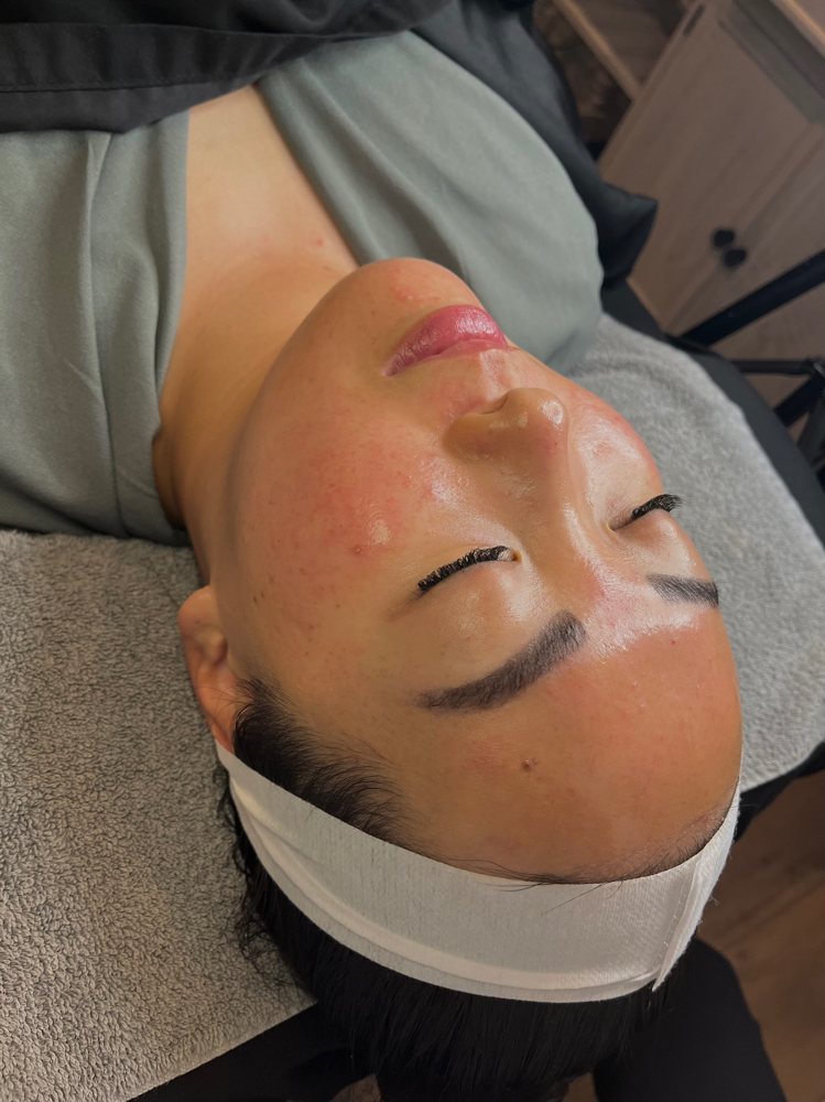 Brightening Chemical Peel 💛
