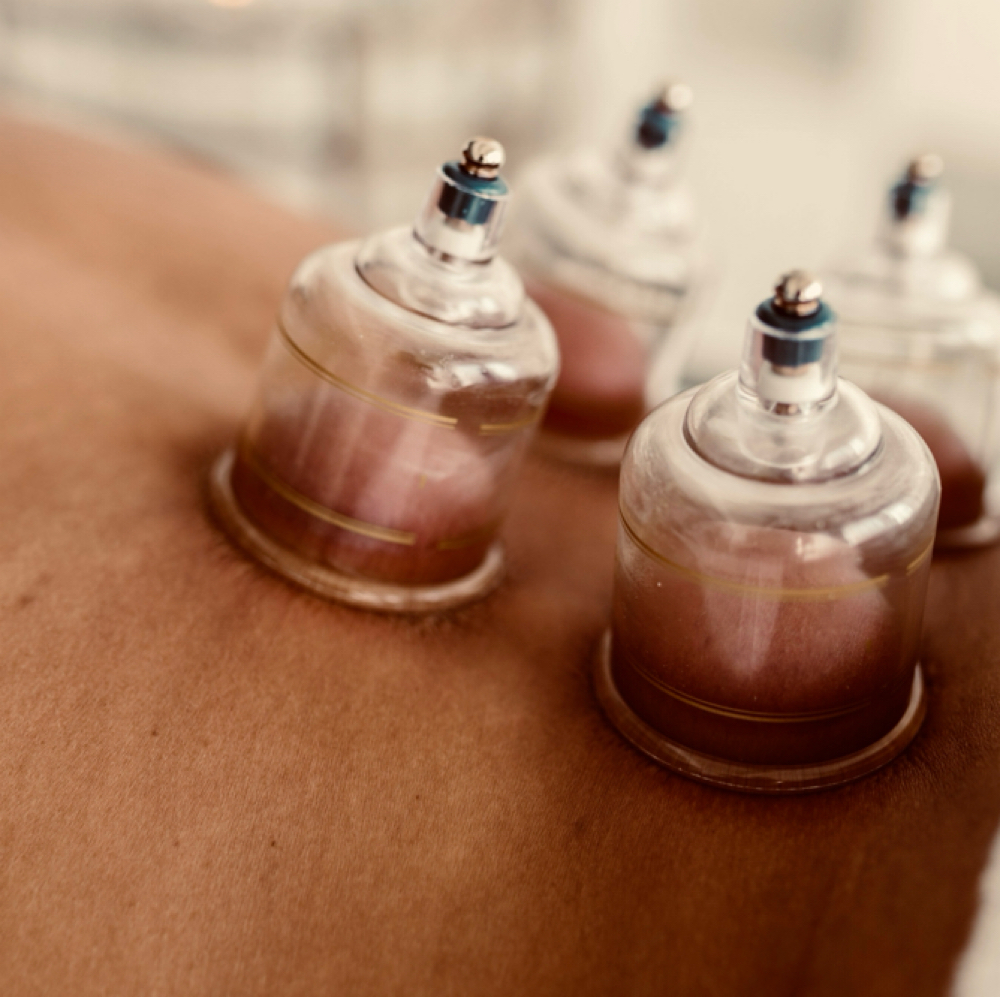Cupping Therapy at Remedy Restorative Wellness in Wilmington, DE