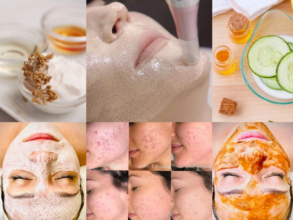 SKINCARE ($15 Off 1st Appointment!)
