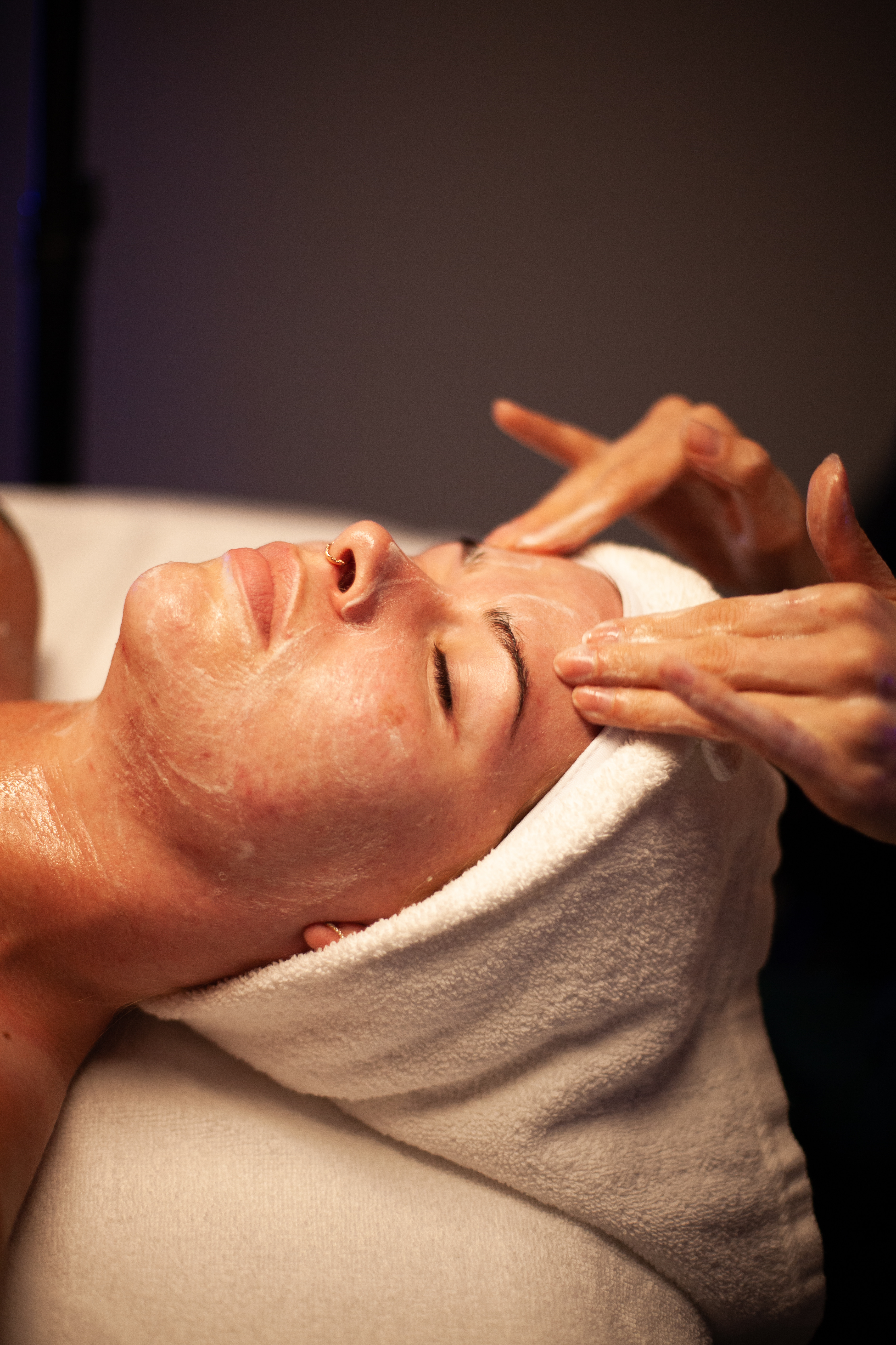 Acne Solution Facial Package (3)