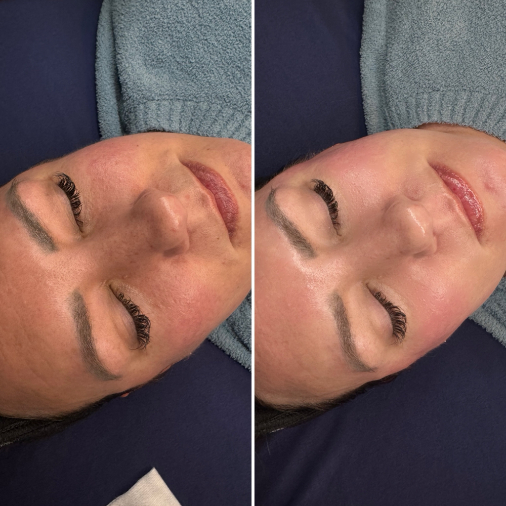 Customized Facial Treatment