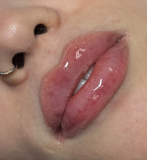 Natural Tinted Lip Filler