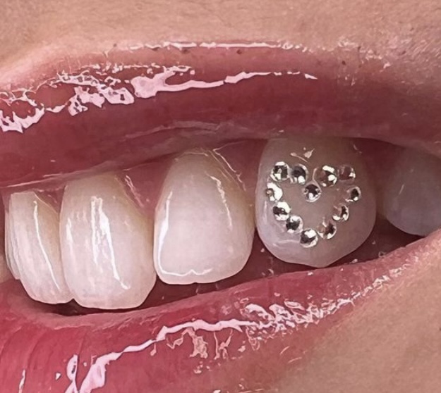 Design Tooth Gem