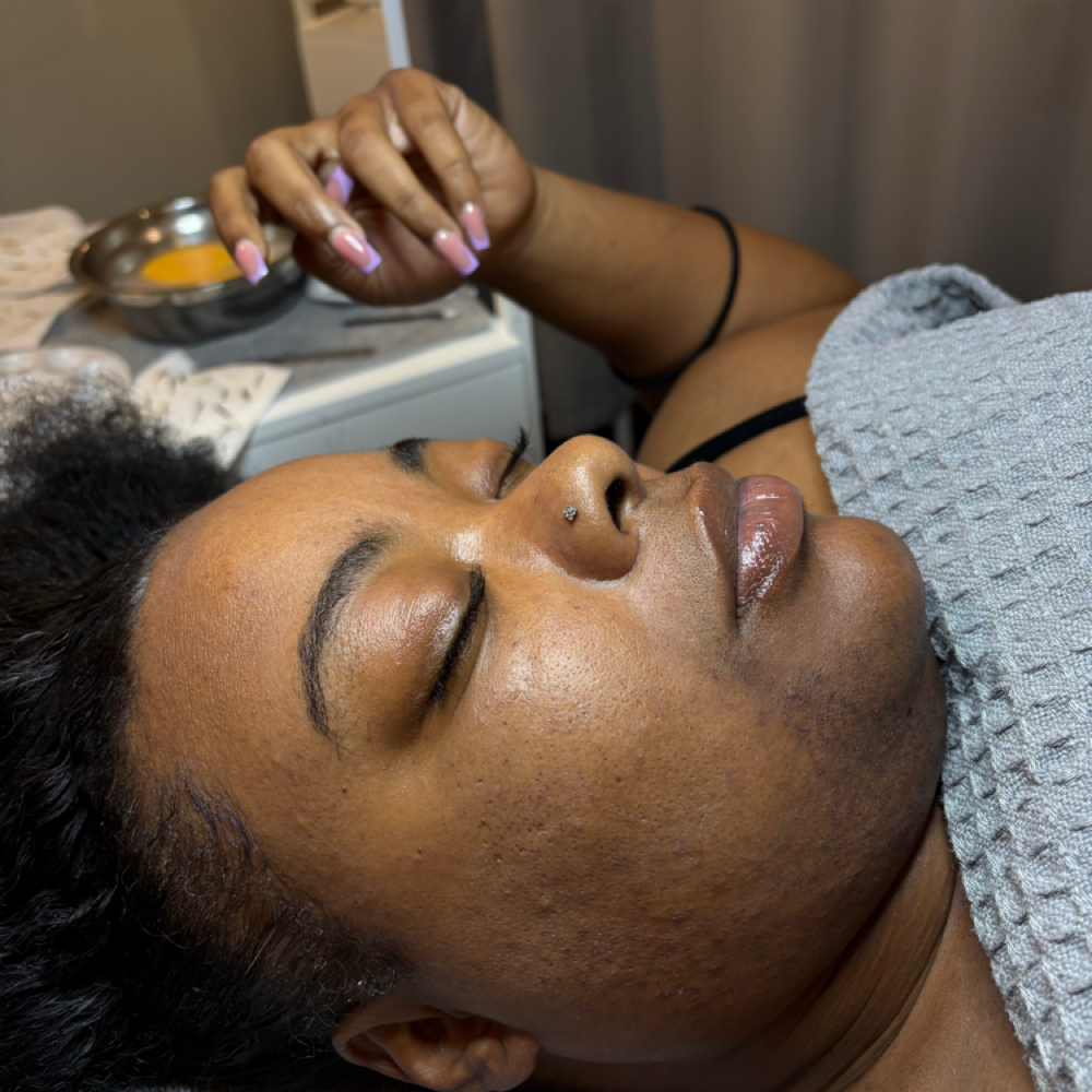 💣 Luxury Dermaplane Facial Glow at B Bomb Beauty Esthetics in Wichita, KS