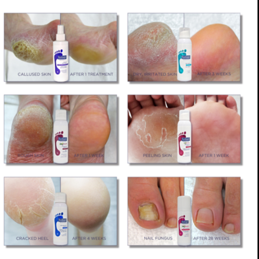 Restorative Pedicures at Jaleisha’s Nail Salón & Spa in Vega Alta, PR