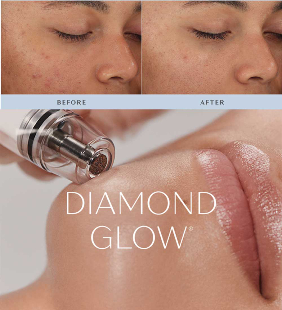 Diamond Glow Facial