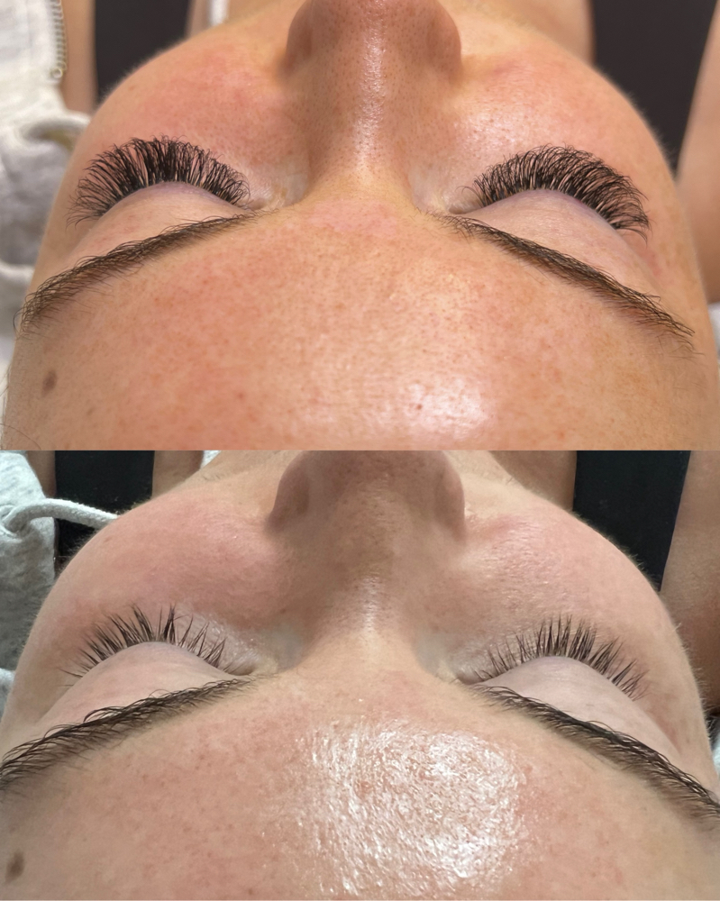 Fullset Hybrid Extensions