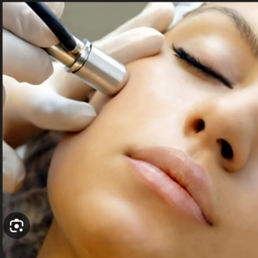 Microdermabrasion Facial at Radiant Veil Skin Studio in El Paso, TX