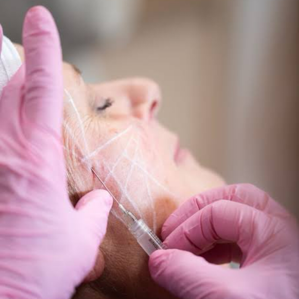 SCULPTRA at Irena Studio & Academy in McAllen, TX