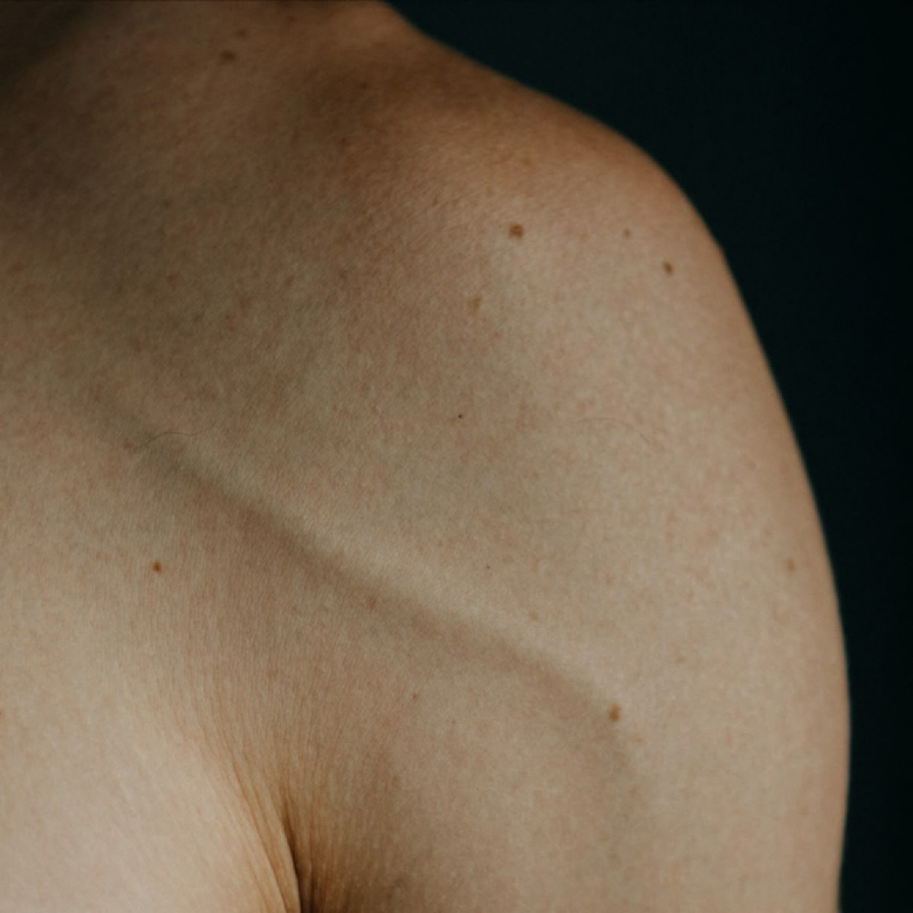 Shoulder at Skintuition Skincare Boutique in Pewee Valley, KY
