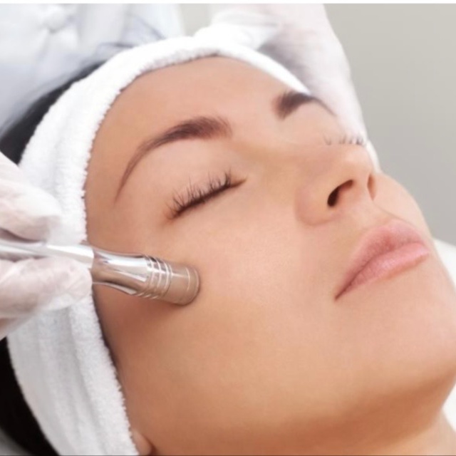 Microdermabrasion Facial at Abide Salon in Chattanooga, TN