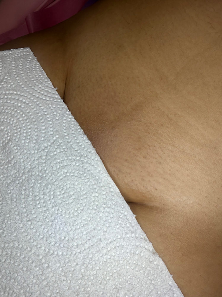 Brazilian Package (6 months)