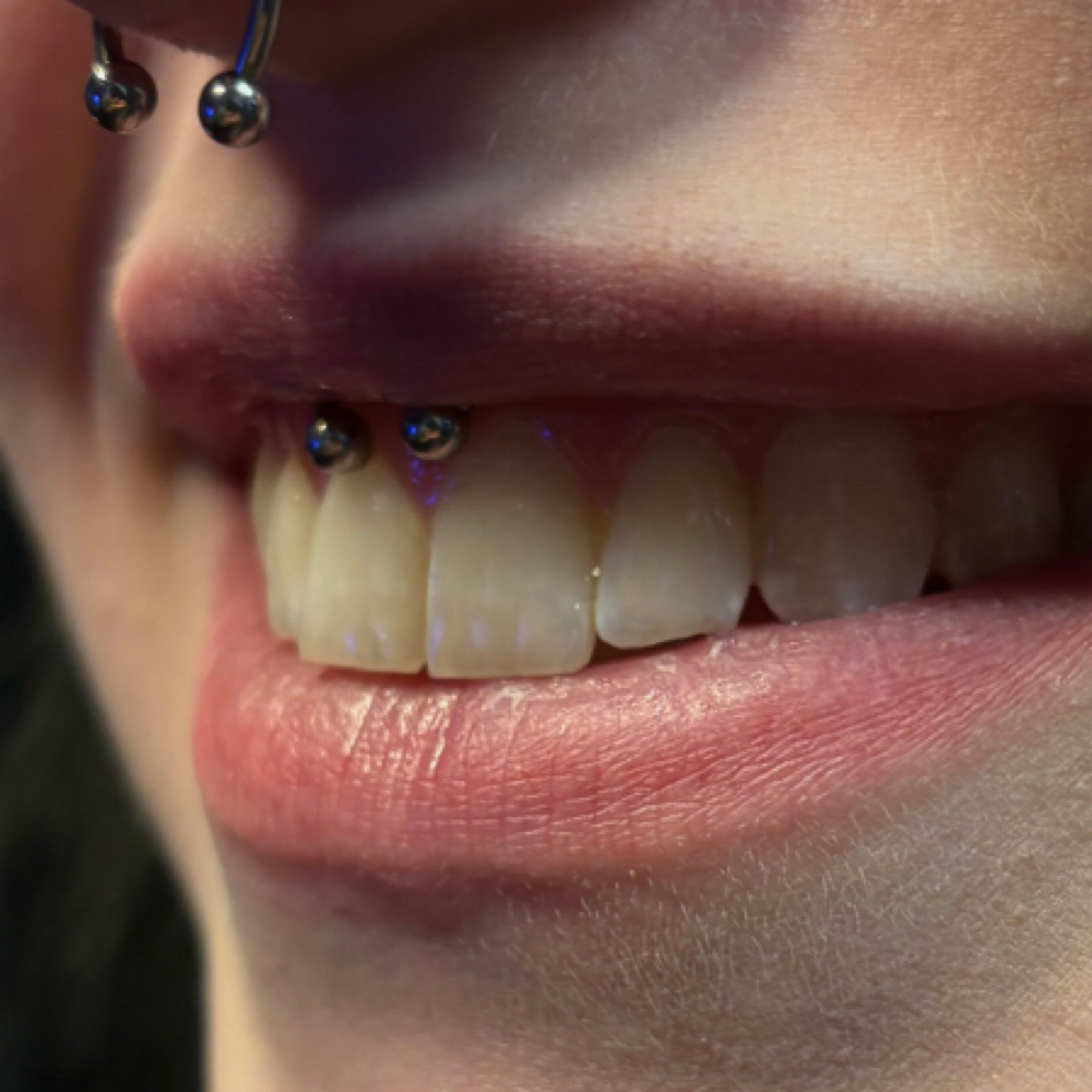 Smiley Piercing at PunkturedByKal in Arlington, TX