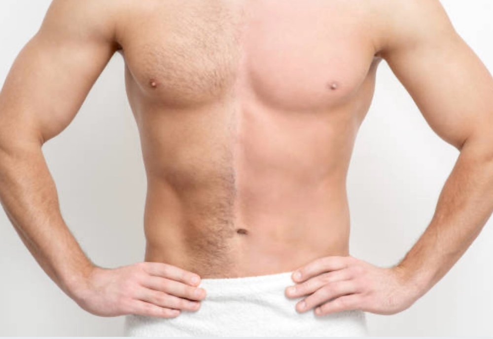 Chest Wax at Wave Wellness & Aesthetics RBNY in Belle harbor, NY