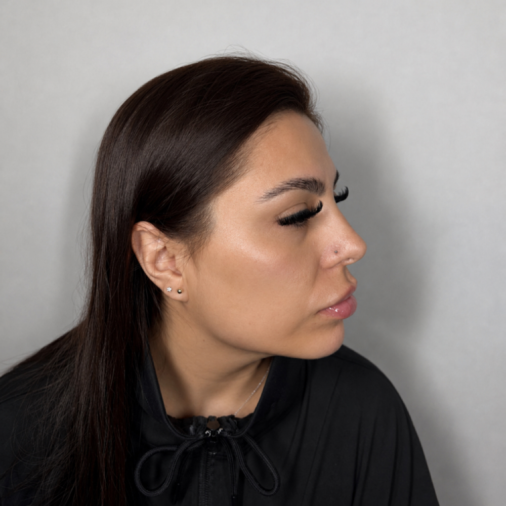 Very Glam Face Lift 5ML at Eluxy Aesthetics in Arlington, TX