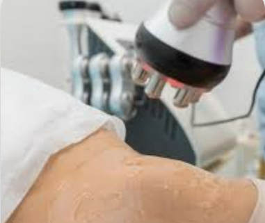 Radiofrequency