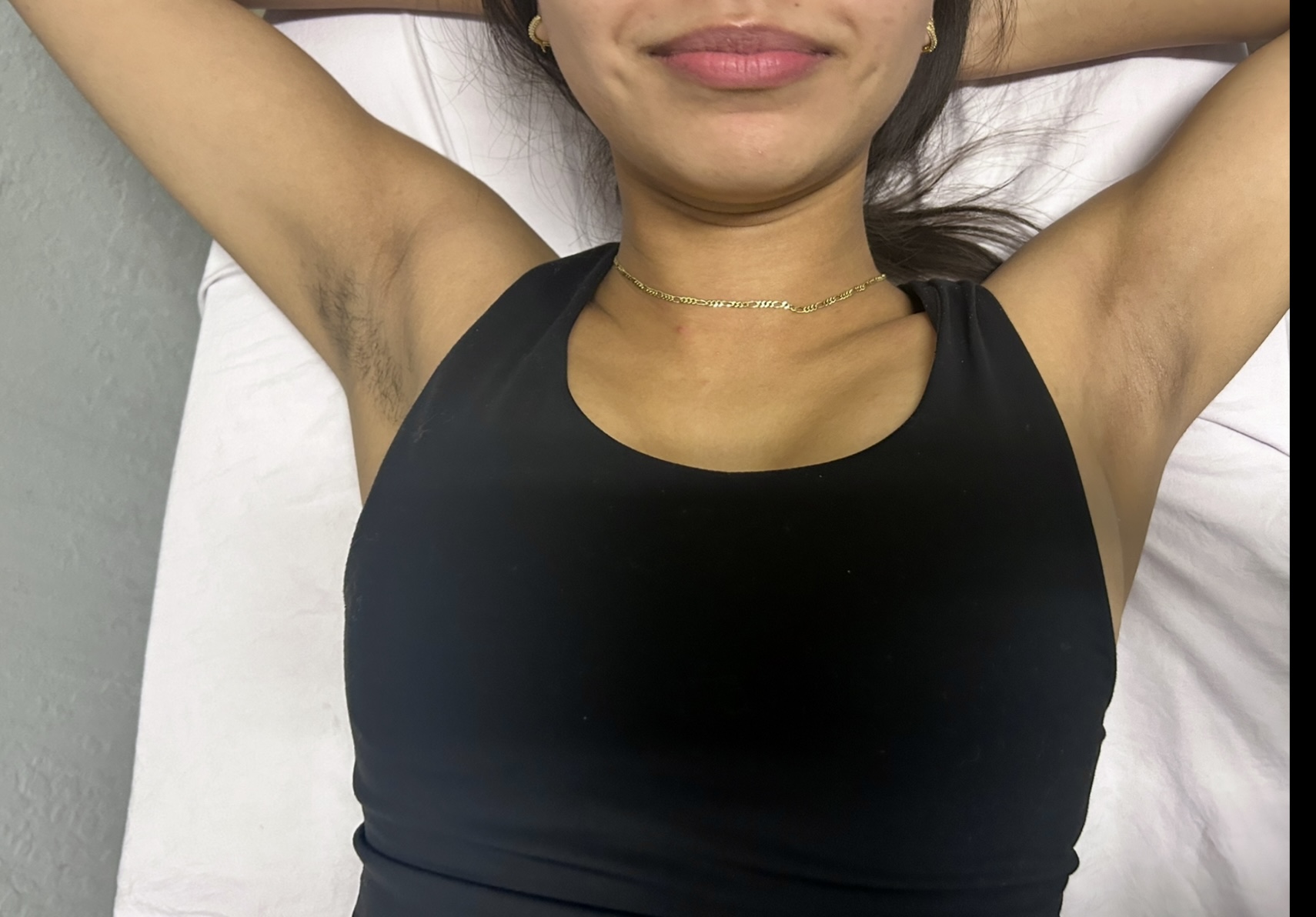 Underarms