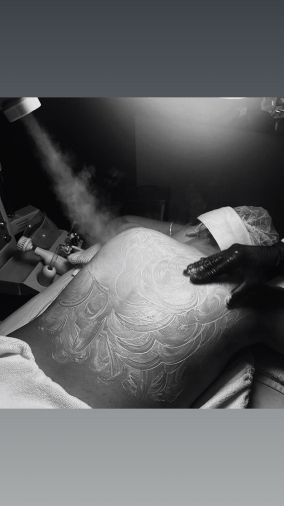 Back Facial🧖🏼‍♀️