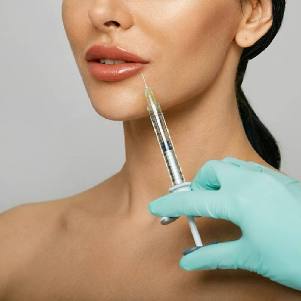 Lip Filler (Full Syringe) at Injections Aesthetics By Lisa in San Antonio, TX