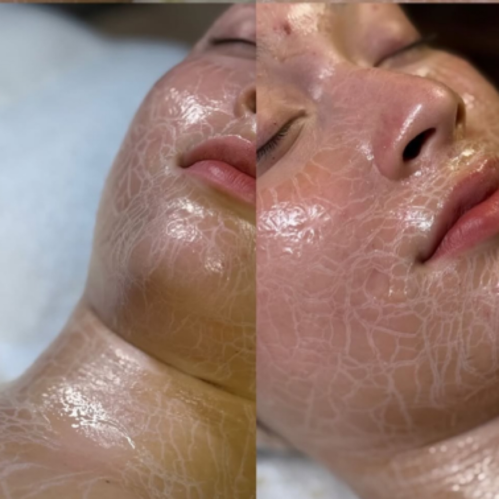 Peptide Firming Facial at Esthetics By Cheynne in Massapequa, NY