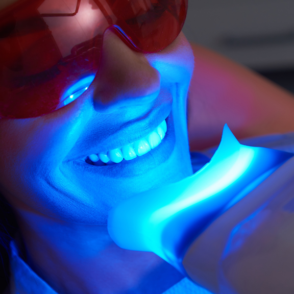 Teeth Whitening