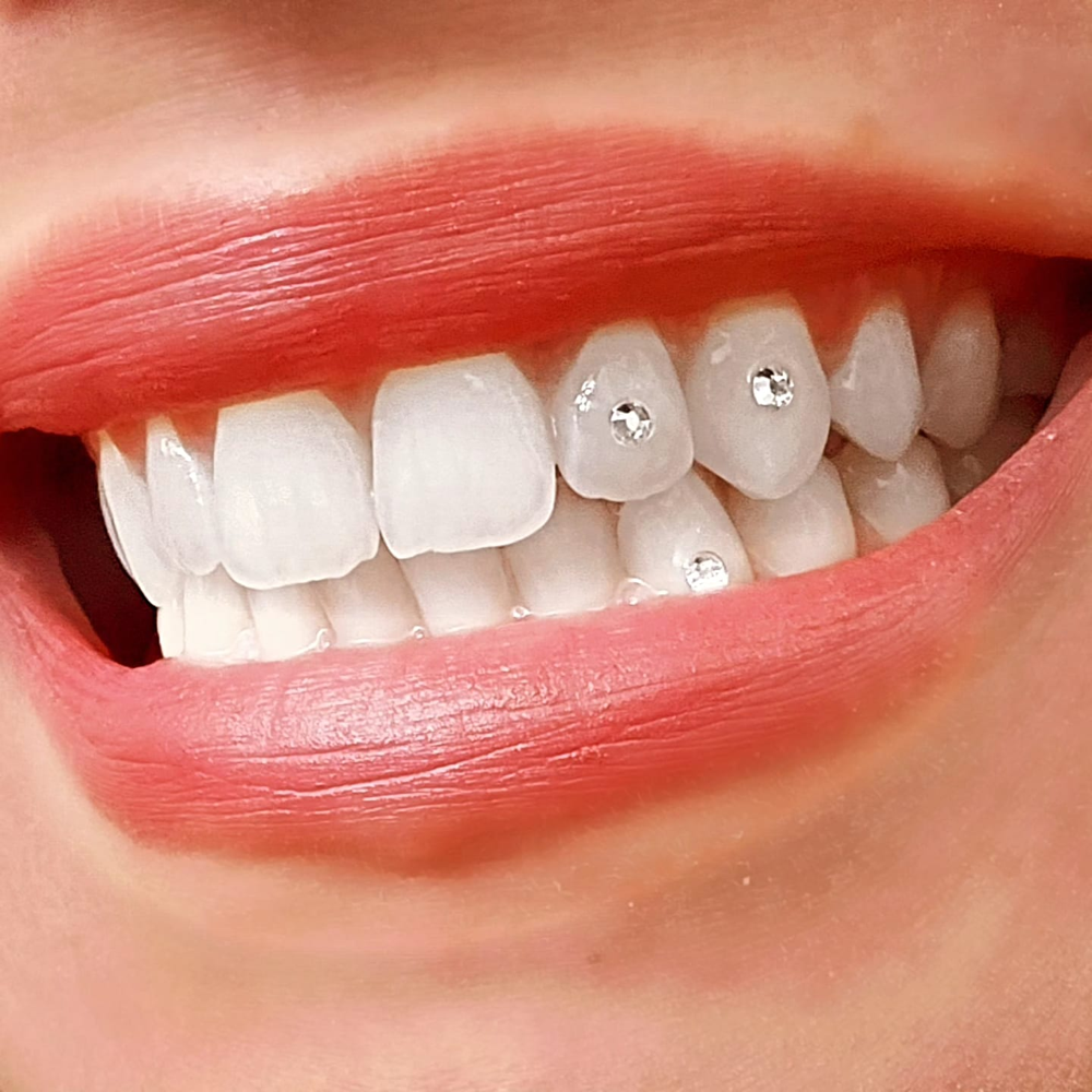 Tooth Gem