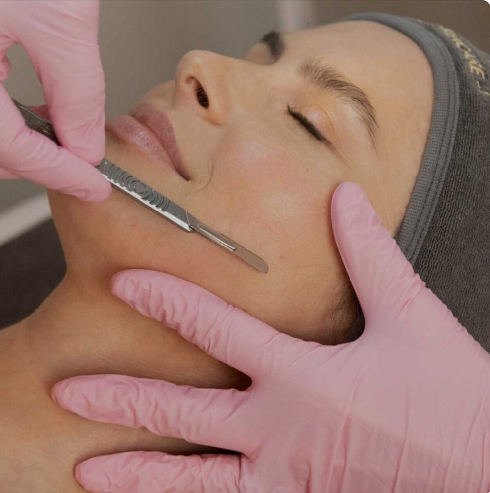 Dermaplaning