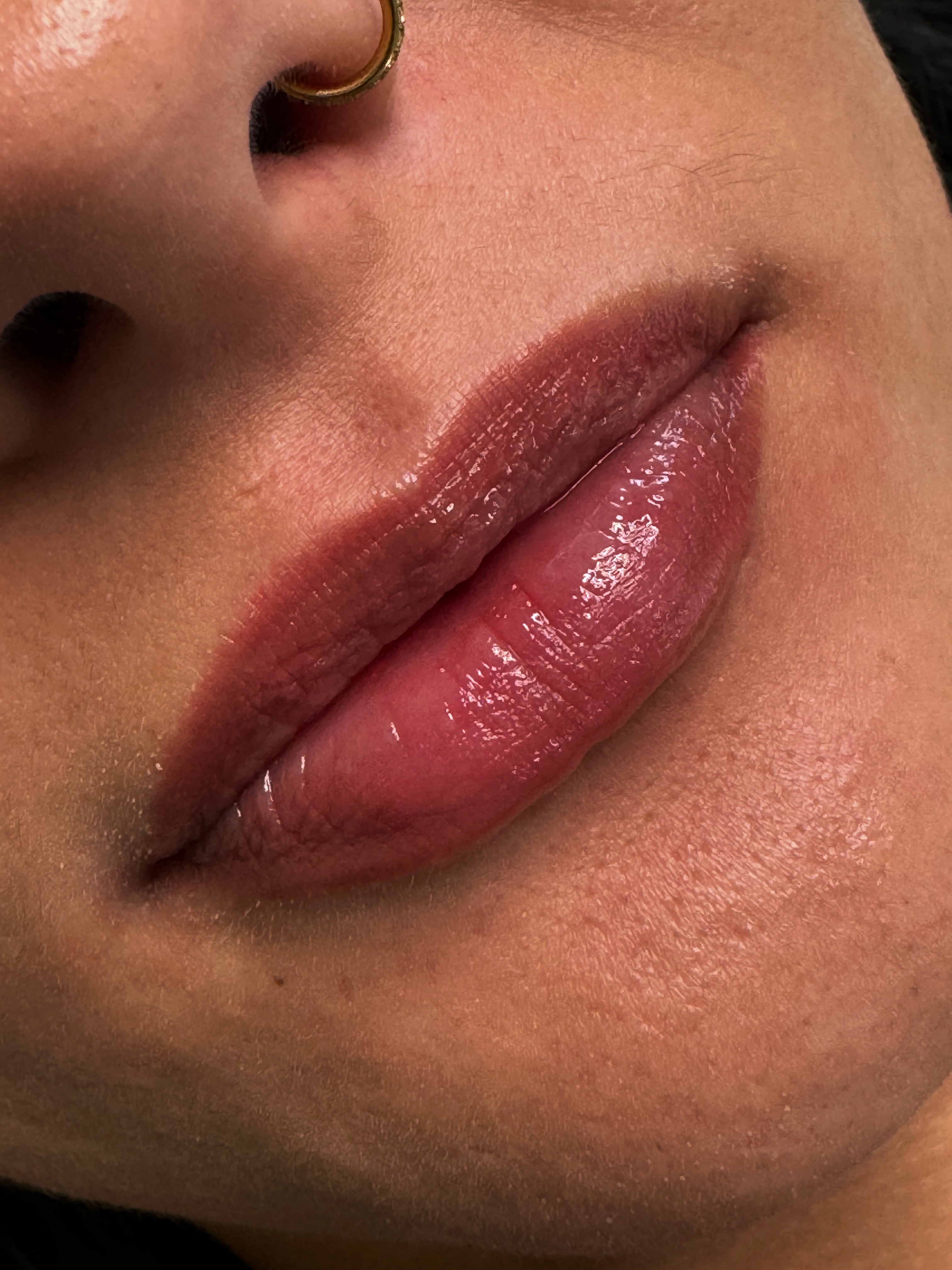 Lip Neutralization