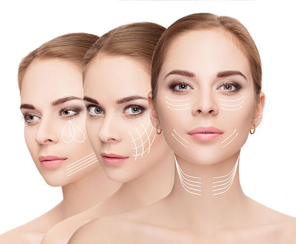 Fibroblast Skin Tightening