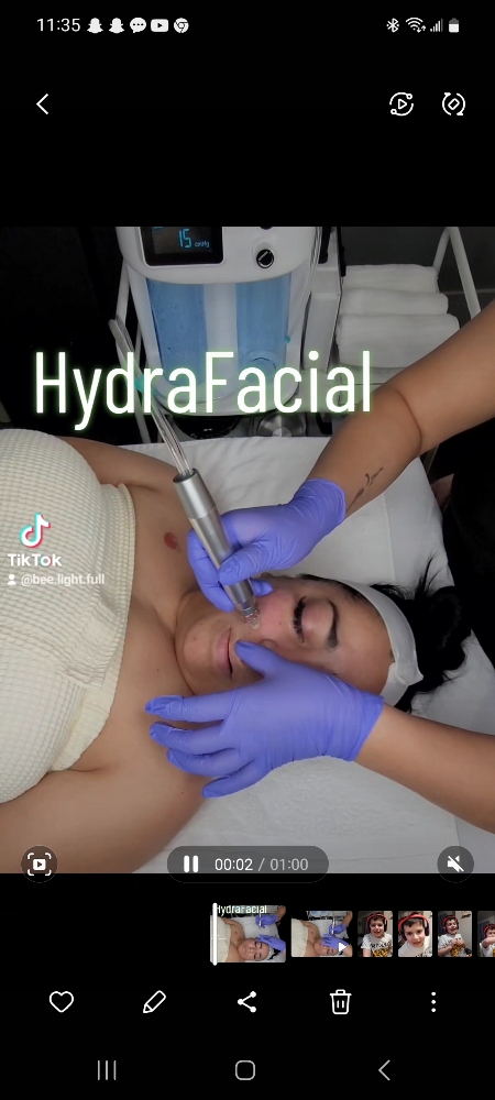 HydraFacial