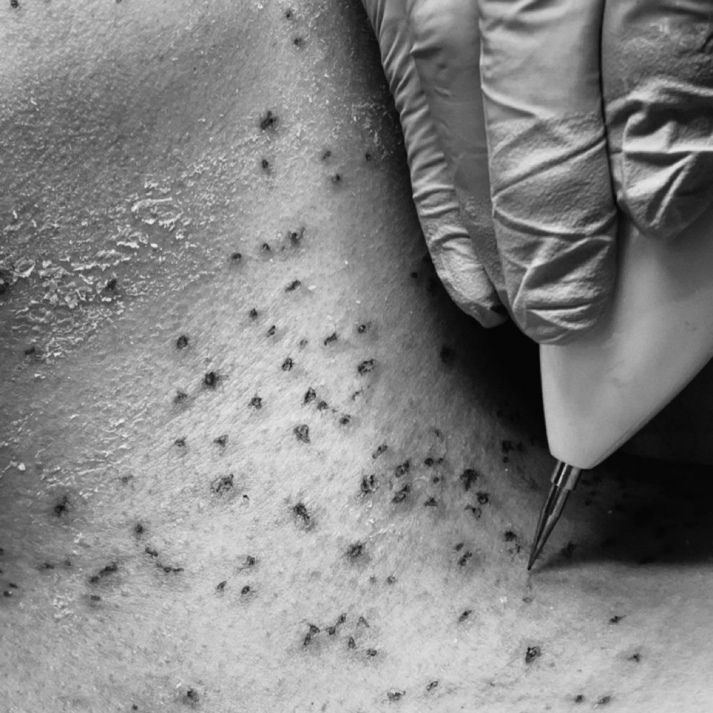Skin Classic at Midnight Aesthetics in Portland, OR