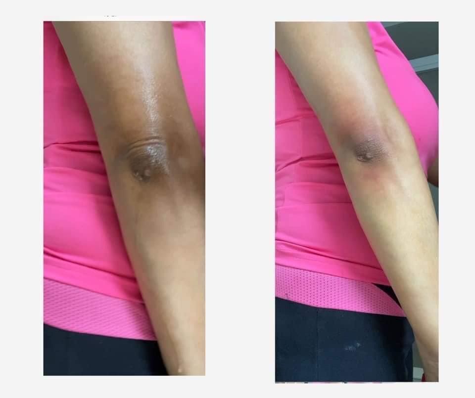 Elbows / codos at LUXOR BEAUTY BAR in ALPHARETTA, GA