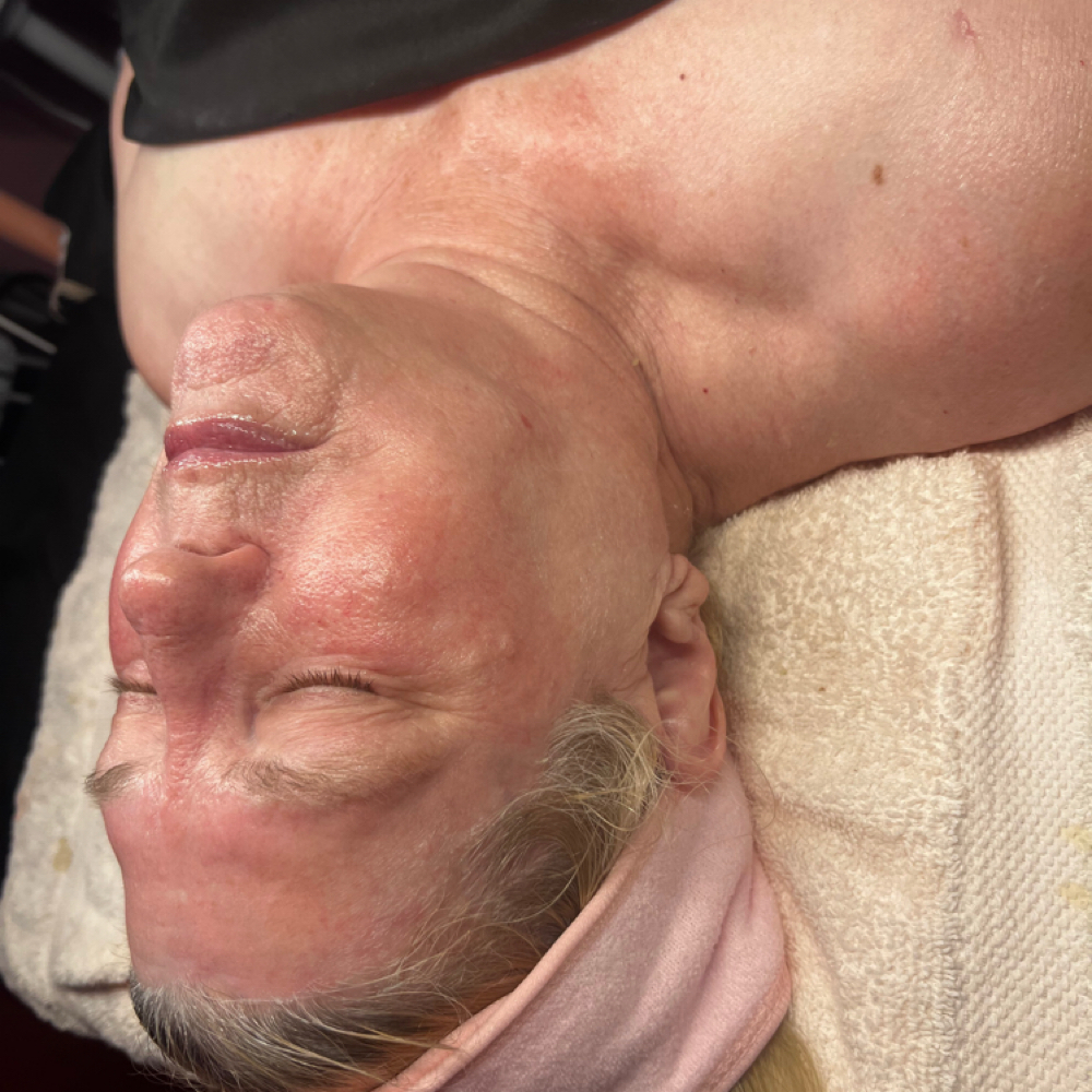 Circadia Firming Peptide Facial at 444esthetics in garden city, MI