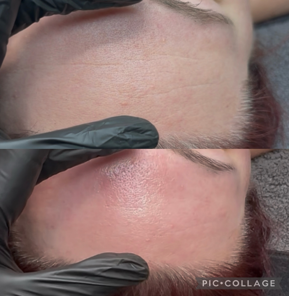 Signature Facial at Ciao Bellä Esthetics WNC in Asheville, NC